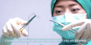 Chăm sóc không để lại sẹo sau khi cắt chỉ vết thương