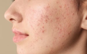 da xuất hiện các vấn đề